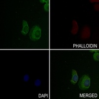 Anti-EMR2 Antibody