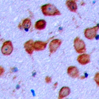 Anti-EPHA6 Antibody