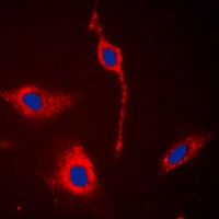 Anti-EPHA6 Antibody