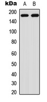 HER2 (Phospho-Y1221/Y1222) Rabbit Polyclonal Antibody