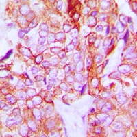 Anti-HER3 (Phospho-Y1328) Antibody