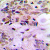 Anti-ERCC5 Antibody