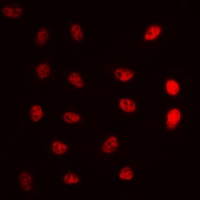Anti-ERCC5 Antibody