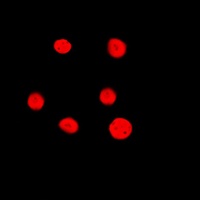Estrogen Receptor beta Antibody