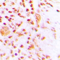 Anti-ETV4 Antibody