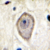 CD142 (Phospho-S290) Antibody