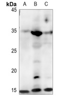 FABP4 Antibody