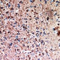 Anti-FAF1 Antibody