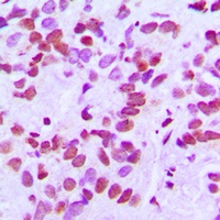 CANP Antibody