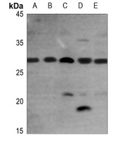 FGF23 Rabbit Polyclonal Antibody