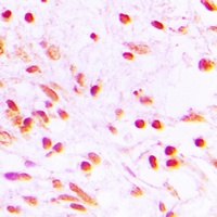 Anti-FOSL1 Antibody