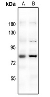 FOXO1 Antibody