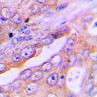FOXO1 Antibody