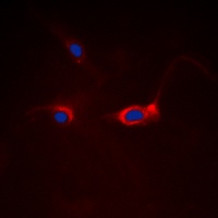 FOXO1 Antibody