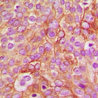 Anti-GABRB1 (Phospho-S434) Antibody