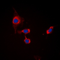 Anti-GABRB1 (Phospho-S434) Antibody