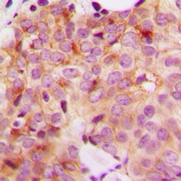 Anti-GAK Antibody