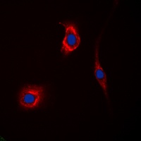 Anti-GAK Antibody