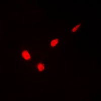 GATA1 (Phospho-S310) Antibody