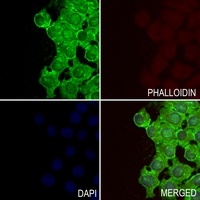 Anti-GIT2 Antibody