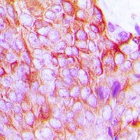 Connexin 43 (Phospho-S368) Rabbit Polyclonal Antibody
