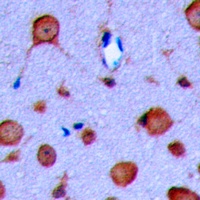 Anti-GLP-1 Receptor Antibody