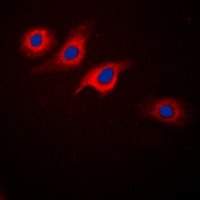 Anti-GLP-1 Receptor Antibody