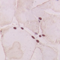 Anti-GNAT1 Antibody