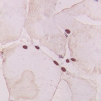 GNAT1 antibody