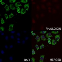 Anti-GNG13 Antibody