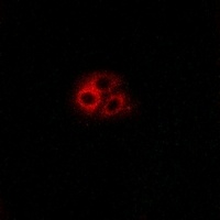 Anti-GNG5 Antibody