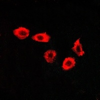 Anti-GPR123 Antibody