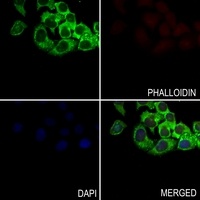 Anti-GPRIN1 Antibody