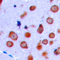Anti-NMDAR1 Antibody