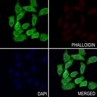 Beta-glucuronidase Antibody