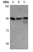 GYS1 (Phospho-S645) Antibody