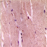 GYS1 (phospho-S645) antibody