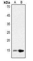 Histone H2B (Acetyl-K12) Rabbit Polyclonal Antibody