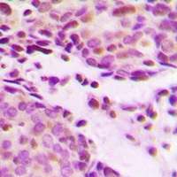 Histone H2B (Acetyl-K12) Rabbit Polyclonal Antibody
