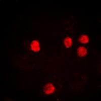 Histone H2B (AcK12) antibody