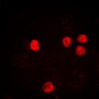Histone H2B (Acetyl-K12) Rabbit Polyclonal Antibody