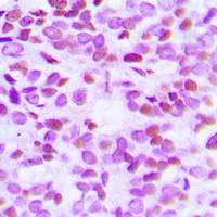 Anti-Histone H2B (Acetyl-K15) Antibody