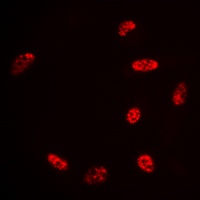 Histone H2B (AcK15) antibody