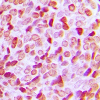 Anti-Histone Deacetylase 1 Antibody