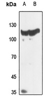 Histone Deacetylase 5/9 Antibody