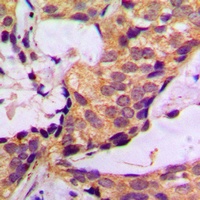 Histone Deacetylase 6 Rabbit Polyclonal Antibody