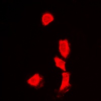 Histone Deacetylase 6 Rabbit Polyclonal Antibody