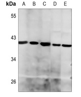 Histone Deacetylase 8 Antibody