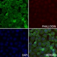 Histone Deacetylase 8 Antibody