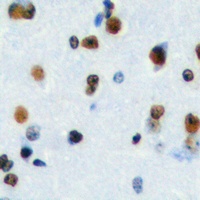 Anti-HEN1/2 Antibody
